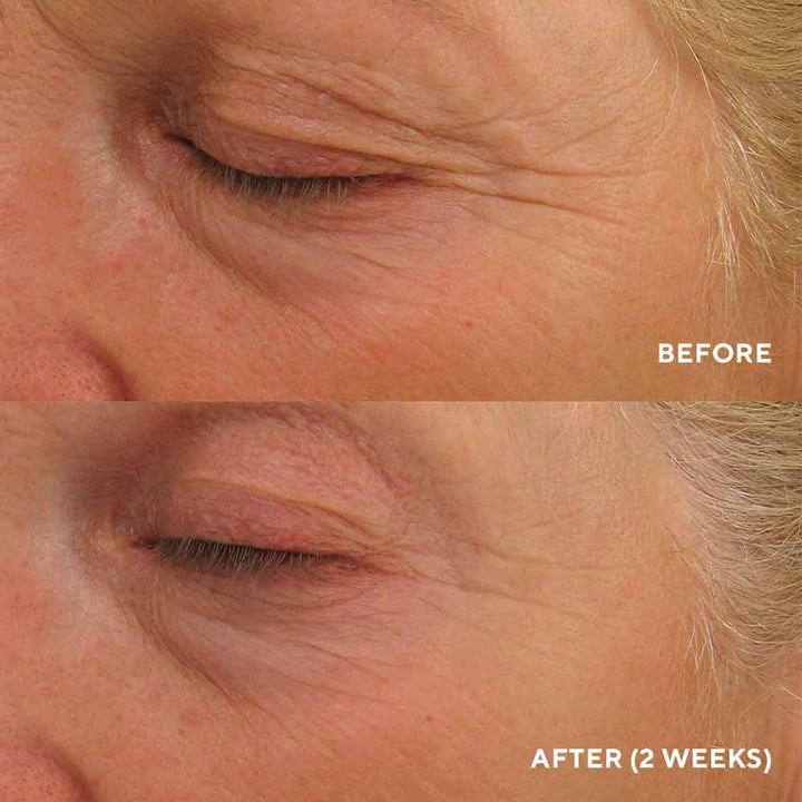 Eye Authority – Інтенсивний ліфтинг-крем для повік