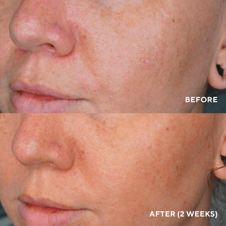 LumaPro-C – Сироватка для усунення пігментації