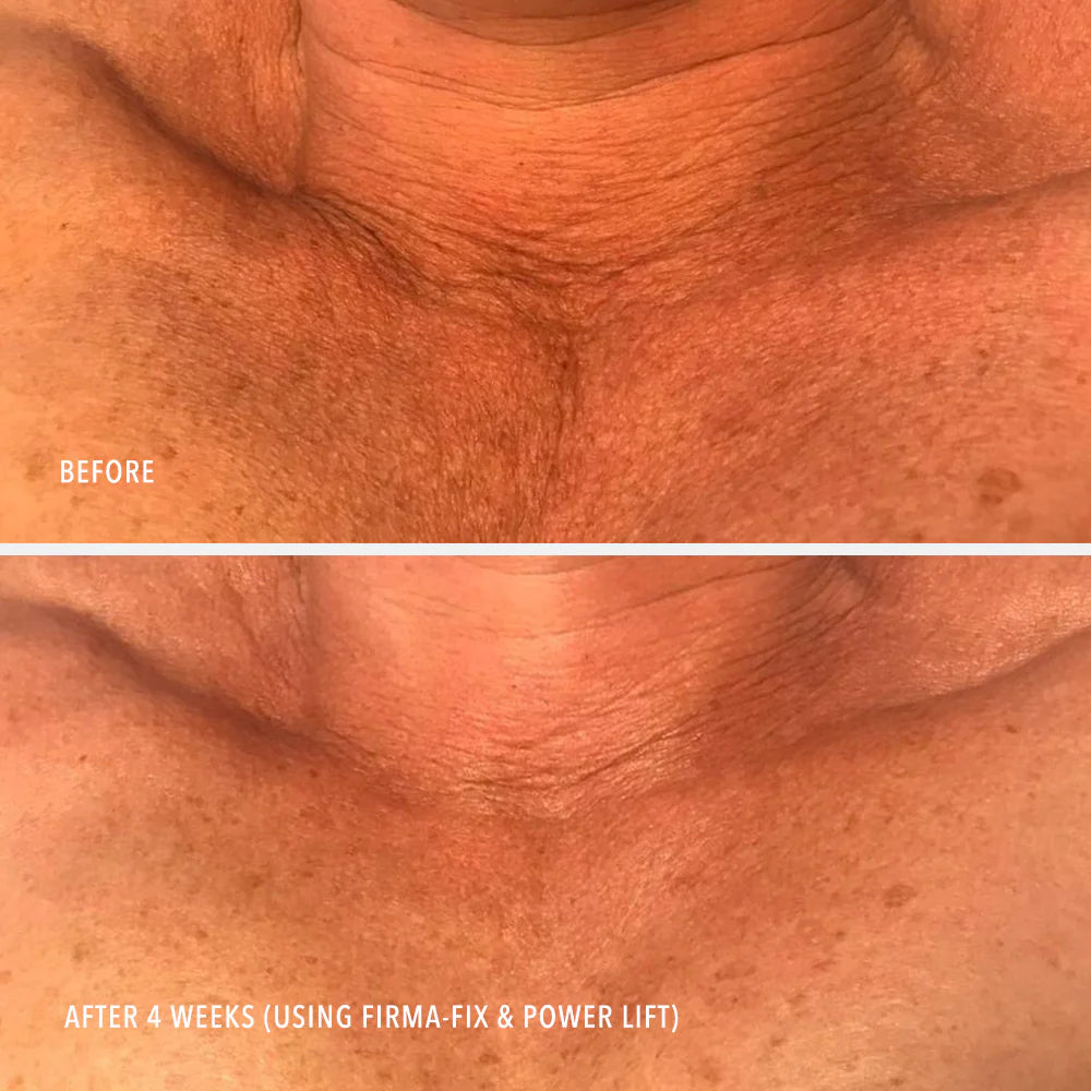 Firm-A-Fix Nectar – Ліфтинг-сироватка для шиї та декольте