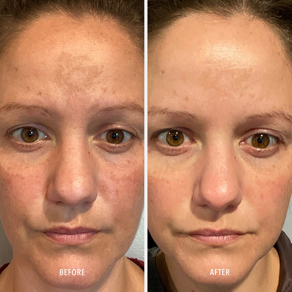 Firma-Bright – Зміцнювальний концентрат для освітлення і захисту шкіри