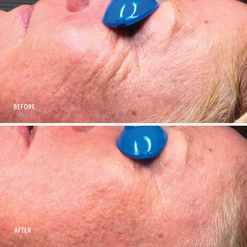 Collagen ReActivate PM – Зволожувальний ліфтинг-крем з ретинолом