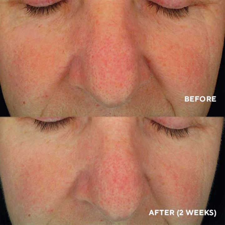 Soothing Serum – Заспокійлива сироватка